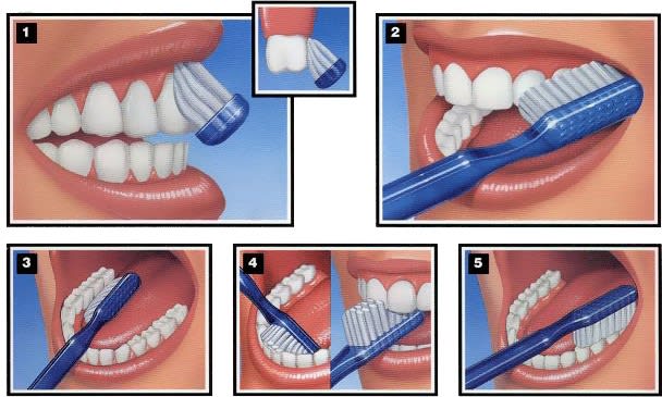 brushing gums